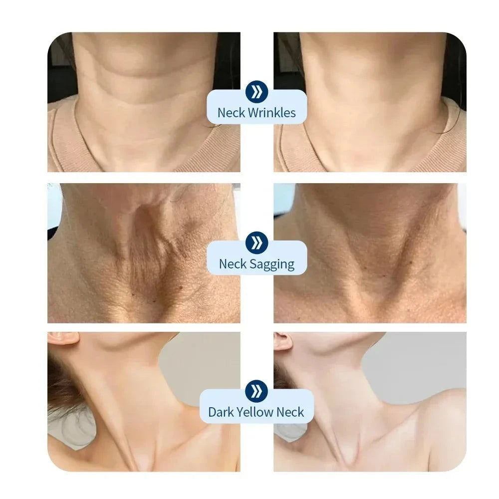 Velura Neck Renewal Mask